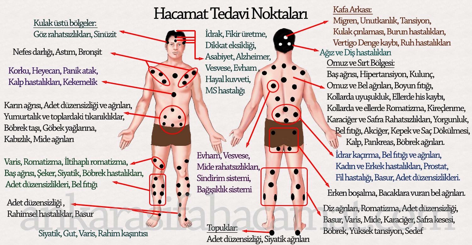 Vesvese için hacamat